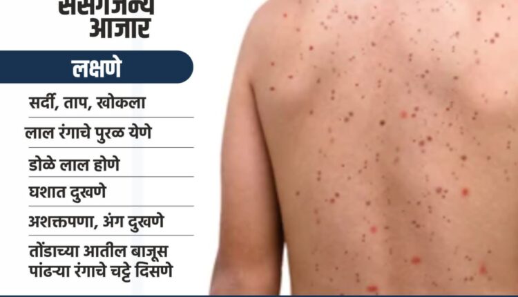 Measles preventive vaccination campaign from December 15 in Nashik district